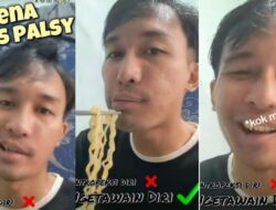 Pria Ini Alami Bell’s Palsy Sampai Mulutnya Miring Sebelah, Dokter Saraf Angkat Bicara