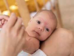 Moms, Kenali Eksim pada Bayi dan Trik Mengobatinya : Okezone Women