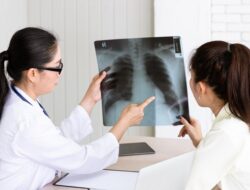Jangan Salah Paham! Ternyata Tidak Semua Jenis TB Bisa Menular : Okezone Women