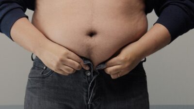 Studi Ungkap 23 dari 26 Peserta dengan Obesitas Mengalami Penurunan Lemak Hati : Okezone Women